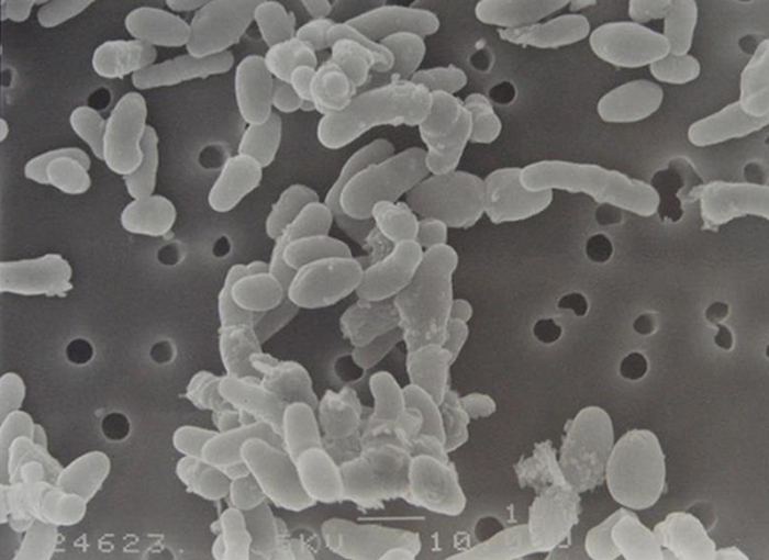 Bifidobacterium breve M-16V